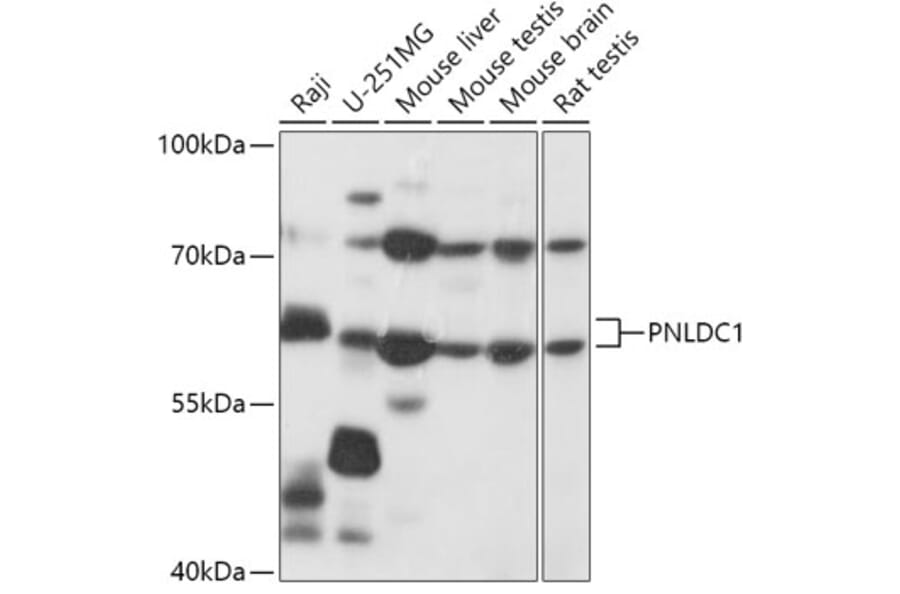 Western Blot - Anti-PNLDC1 Antibody (A305553) - Antibodies.com