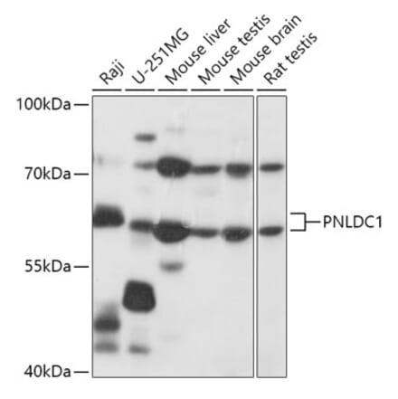 Western Blot - Anti-PNLDC1 Antibody (A305553) - Antibodies.com