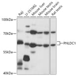 Western Blot - Anti-PNLDC1 Antibody (A305553) - Antibodies.com