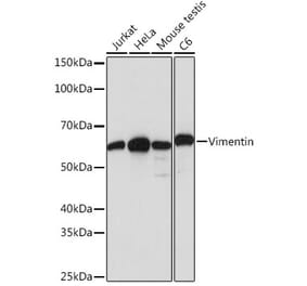Western Blot - Anti-Vimentin Antibody [ARC0086] (A305554) - Antibodies.com