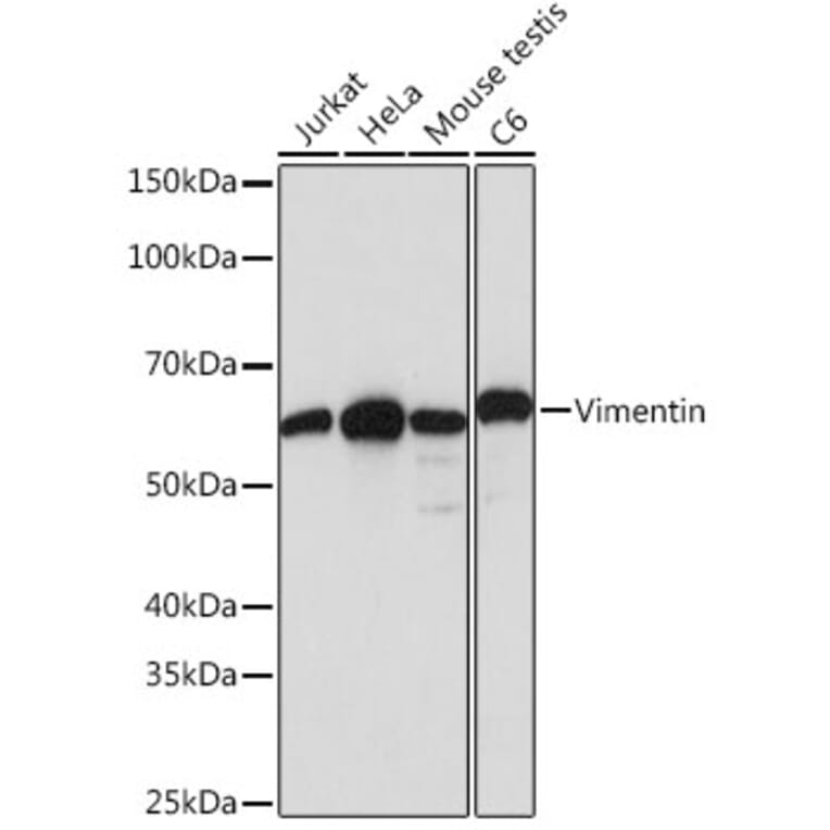 Western Blot - Anti-Vimentin Antibody [ARC0086] (A305554) - Antibodies.com