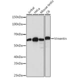 Western Blot - Anti-Vimentin Antibody [ARC0086] (A305554) - Antibodies.com