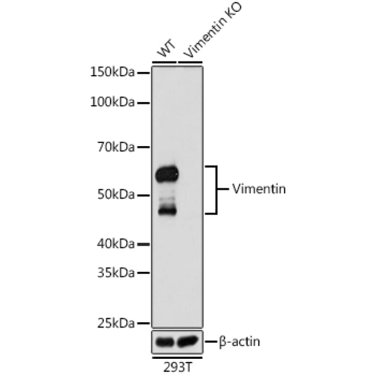 Western Blot - Anti-Vimentin Antibody [ARC0086] (A305554) - Antibodies.com