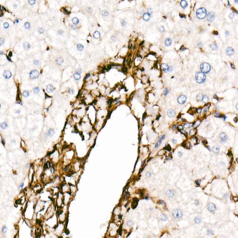 Immunohistochemistry - Anti-Vimentin Antibody [ARC0086] (A305554) - Antibodies.com