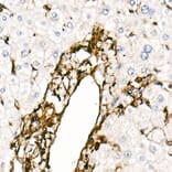 Immunohistochemistry - Anti-Vimentin Antibody [ARC0086] (A305554) - Antibodies.com