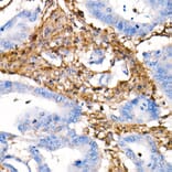 Immunohistochemistry - Anti-Vimentin Antibody [ARC0086] (A305554) - Antibodies.com