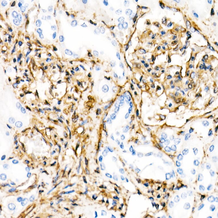 Immunohistochemistry - Anti-Vimentin Antibody [ARC0086] (A305554) - Antibodies.com