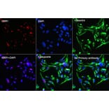 Immunofluorescence - Anti-Vimentin Antibody [ARC0086] (A305554) - Antibodies.com