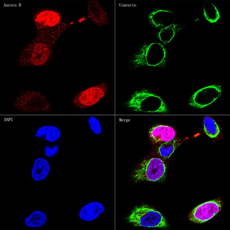 Immunofluorescence - Anti-Vimentin Antibody [ARC0086] (A305554) - Antibodies.com