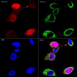 Immunofluorescence - Anti-Vimentin Antibody [ARC0086] (A305554) - Antibodies.com