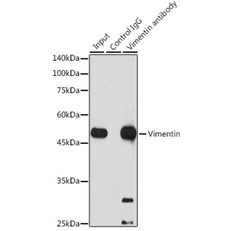 Western Blot - Anti-Vimentin Antibody [ARC0086] (A305554) - Antibodies.com