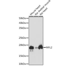 Western Blot - Anti-Myosin Light Chain 2 Antibody [ARC1286] (A305555) - Antibodies.com