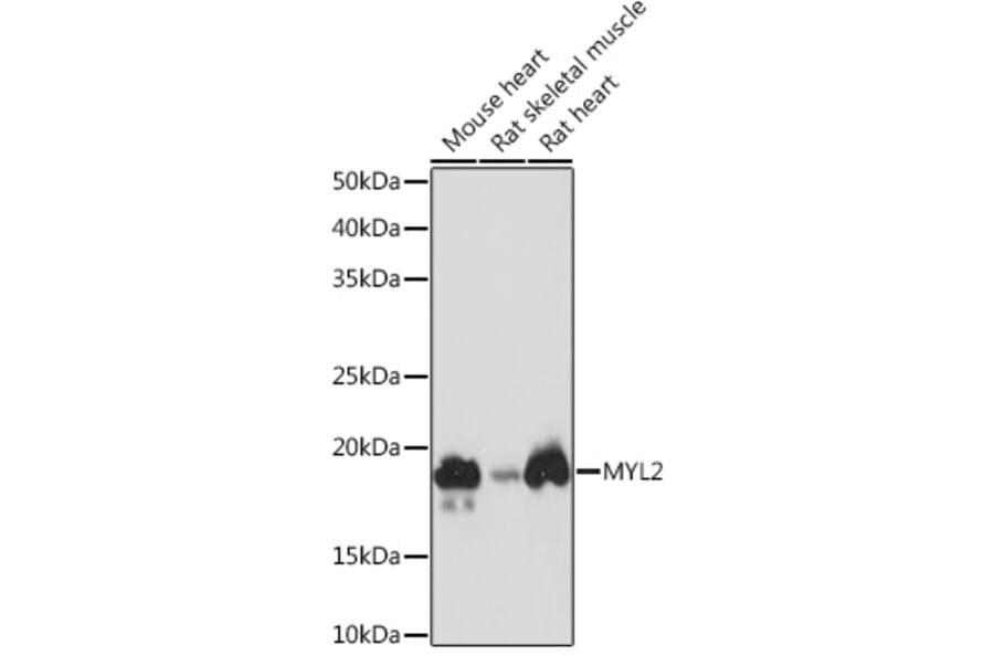 Western Blot - Anti-Myosin Light Chain 2 Antibody [ARC1286] (A305555) - Antibodies.com