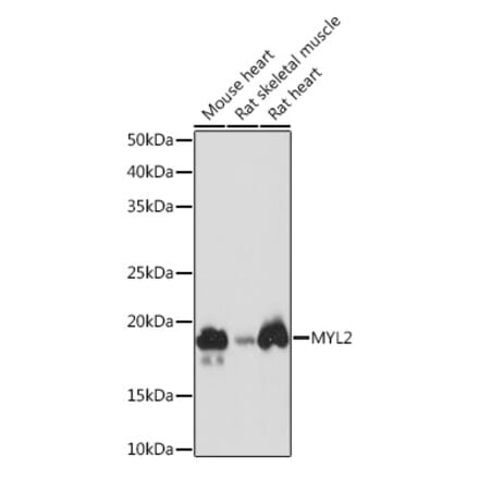 Western Blot - Anti-Myosin Light Chain 2 Antibody [ARC1286] (A305555) - Antibodies.com