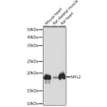 Western Blot - Anti-Myosin Light Chain 2 Antibody [ARC1286] (A305555) - Antibodies.com