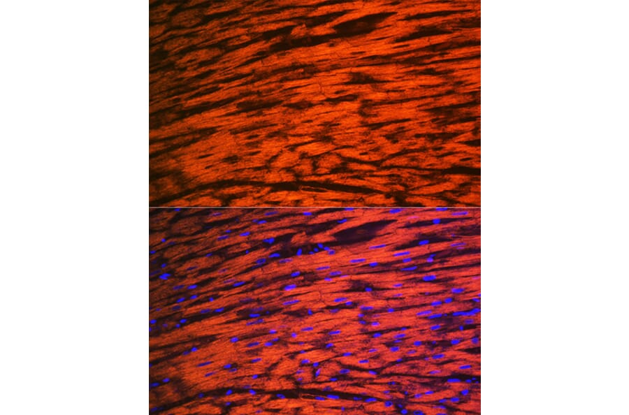 Immunofluorescence - Anti-Myosin Light Chain 2 Antibody [ARC1286] (A305555) - Antibodies.com