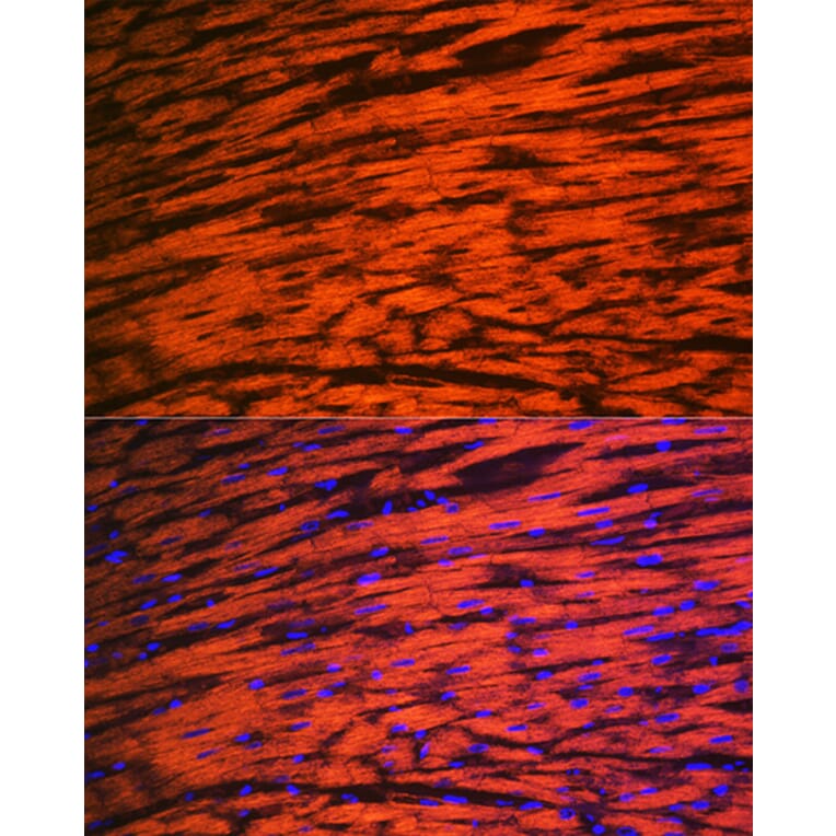Immunofluorescence - Anti-Myosin Light Chain 2 Antibody [ARC1286] (A305555) - Antibodies.com