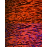 Immunofluorescence - Anti-Myosin Light Chain 2 Antibody [ARC1286] (A305555) - Antibodies.com
