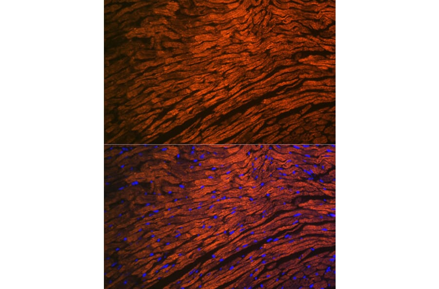 Immunofluorescence - Anti-Myosin Light Chain 2 Antibody [ARC1286] (A305555) - Antibodies.com