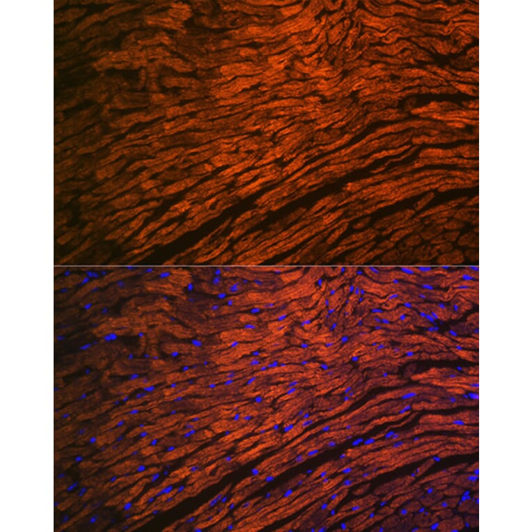 Immunofluorescence - Anti-Myosin Light Chain 2 Antibody [ARC1286] (A305555) - Antibodies.com