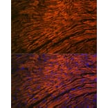 Immunofluorescence - Anti-Myosin Light Chain 2 Antibody [ARC1286] (A305555) - Antibodies.com