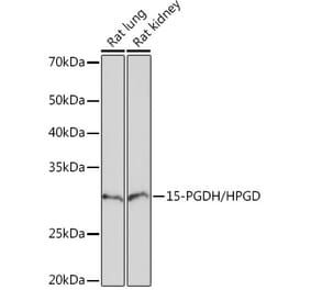 Western Blot - Anti-15-PGDH Antibody [ARC1280] (A305556) - Antibodies.com