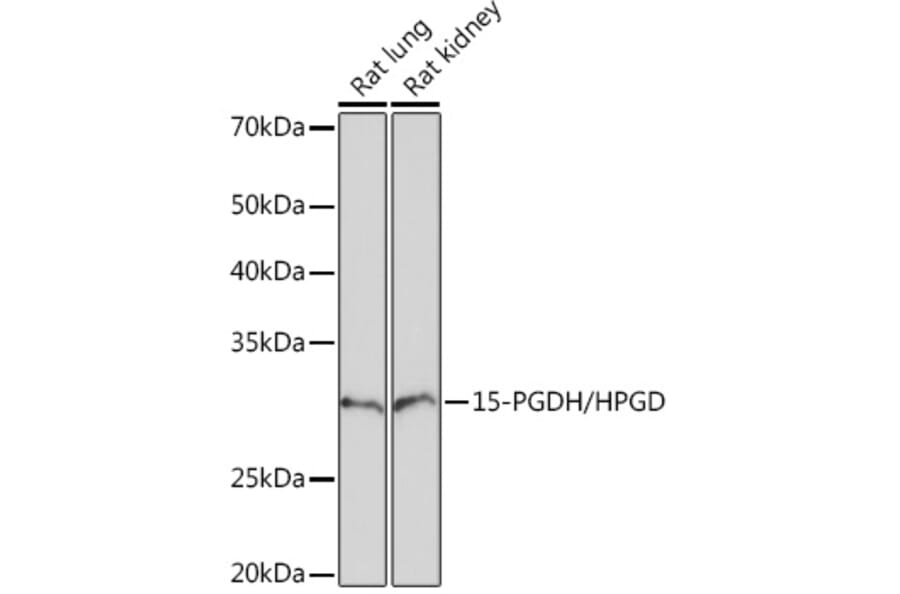 Western Blot - Anti-15-PGDH Antibody [ARC1280] (A305556) - Antibodies.com