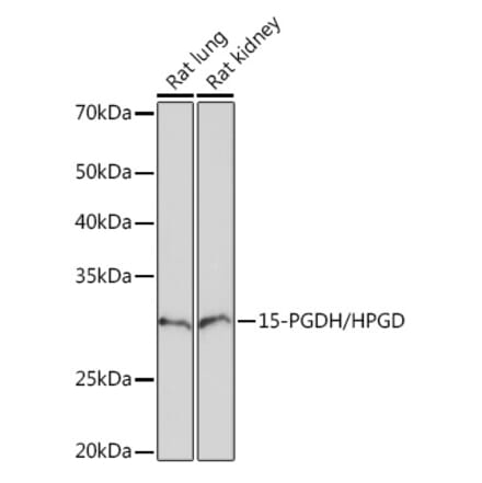 Western Blot - Anti-15-PGDH Antibody [ARC1280] (A305556) - Antibodies.com