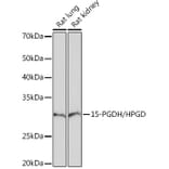 Western Blot - Anti-15-PGDH Antibody [ARC1280] (A305556) - Antibodies.com