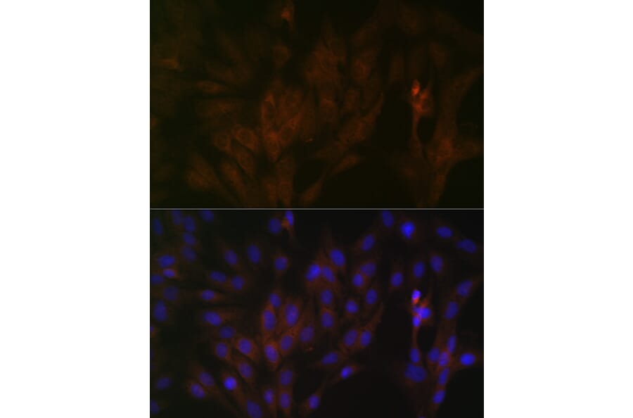 Immunofluorescence - Anti-15-PGDH Antibody [ARC1280] (A305556) - Antibodies.com
