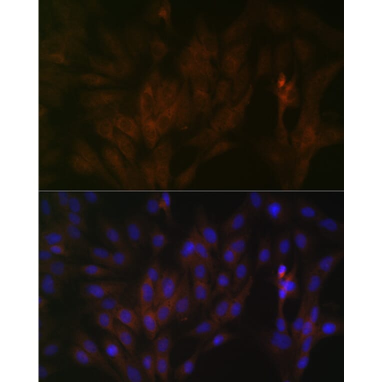 Immunofluorescence - Anti-15-PGDH Antibody [ARC1280] (A305556) - Antibodies.com