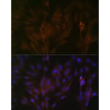 Immunofluorescence - Anti-15-PGDH Antibody [ARC1280] (A305556) - Antibodies.com