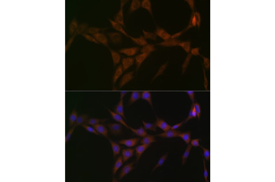 Immunofluorescence - Anti-15-PGDH Antibody [ARC1280] (A305556) - Antibodies.com