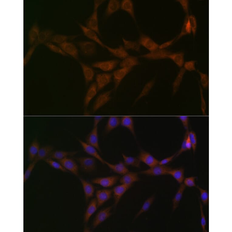 Immunofluorescence - Anti-15-PGDH Antibody [ARC1280] (A305556) - Antibodies.com