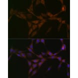 Immunofluorescence - Anti-15-PGDH Antibody [ARC1280] (A305556) - Antibodies.com