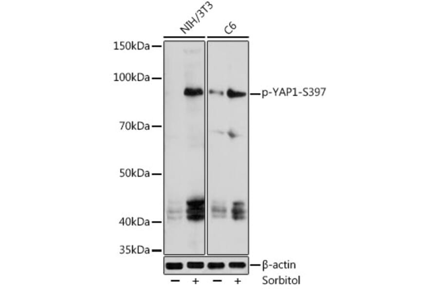 Western Blot - Anti-YAP1 (Phospho S397) Antibody (A305557) - Antibodies.com