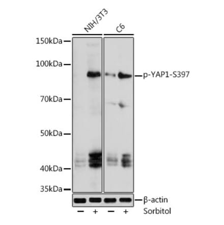 Western Blot - Anti-YAP1 (Phospho S397) Antibody (A305557) - Antibodies.com