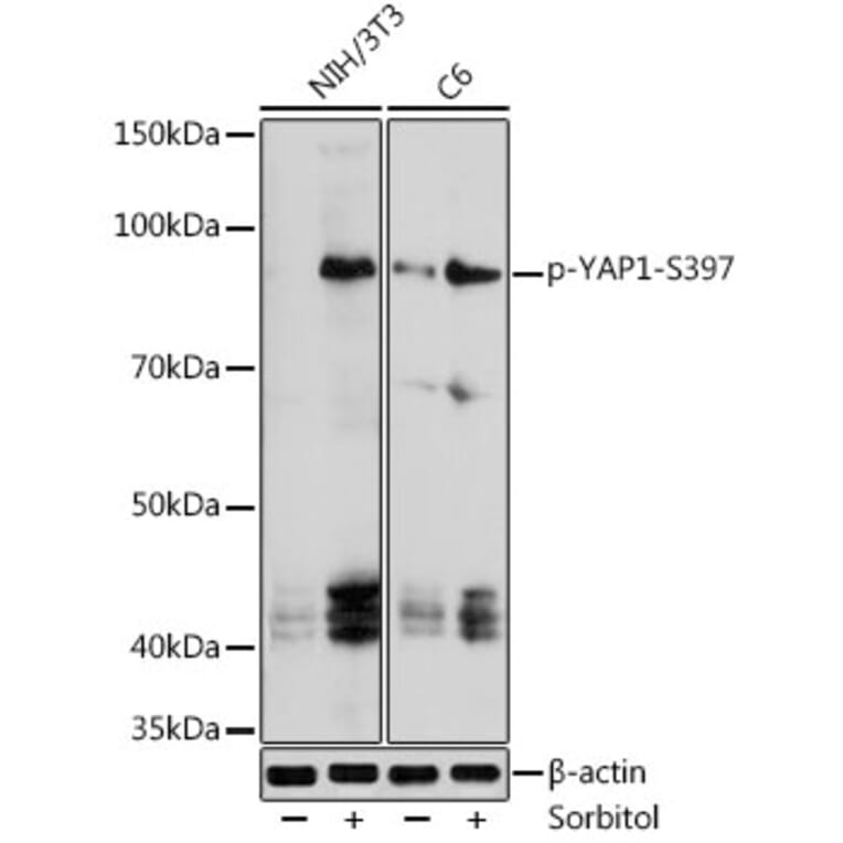 Western Blot - Anti-YAP1 (Phospho S397) Antibody (A305557) - Antibodies.com