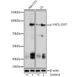 Western Blot - Anti-YAP1 (Phospho S397) Antibody (A305557) - Antibodies.com