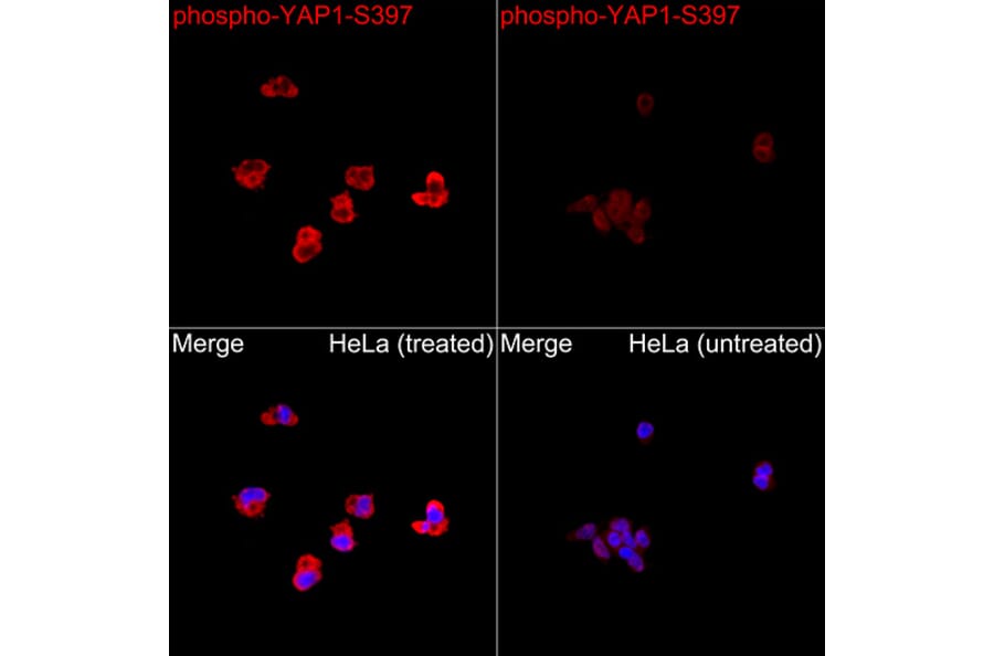 Immunofluorescence - Anti-YAP1 (Phospho S397) Antibody (A305557) - Antibodies.com