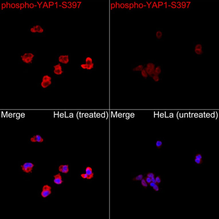 Immunofluorescence - Anti-YAP1 (Phospho S397) Antibody (A305557) - Antibodies.com