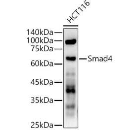 Western Blot - Anti-Smad4 Antibody (A305558) - Antibodies.com