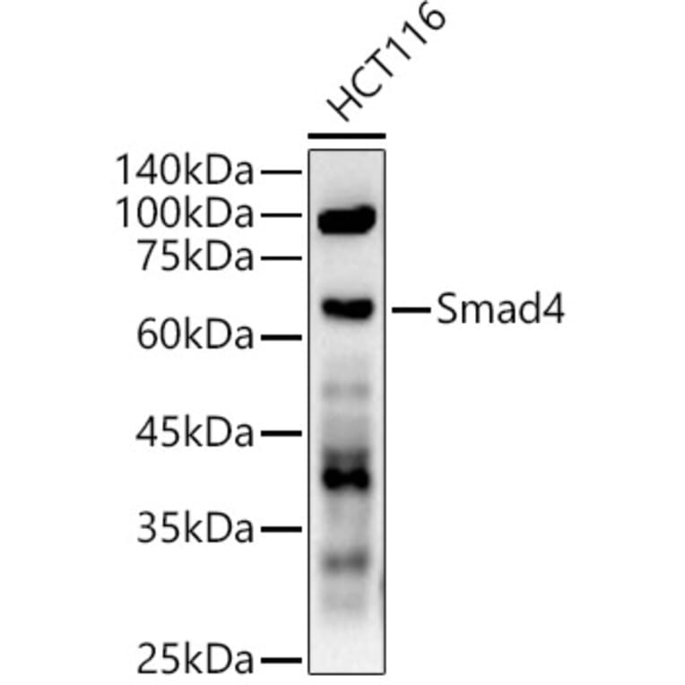 Western Blot - Anti-Smad4 Antibody (A305558) - Antibodies.com