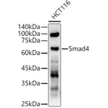 Western Blot - Anti-Smad4 Antibody (A305558) - Antibodies.com