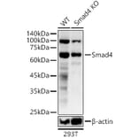 Western Blot - Anti-Smad4 Antibody (A305558) - Antibodies.com