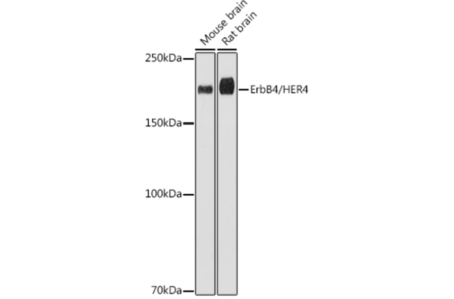 Western Blot - Anti-ErbB4/HER4 Antibody [ARC2639] (A305559) - Antibodies.com