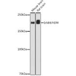 Western Blot - Anti-ErbB4/HER4 Antibody [ARC2639] (A305559) - Antibodies.com