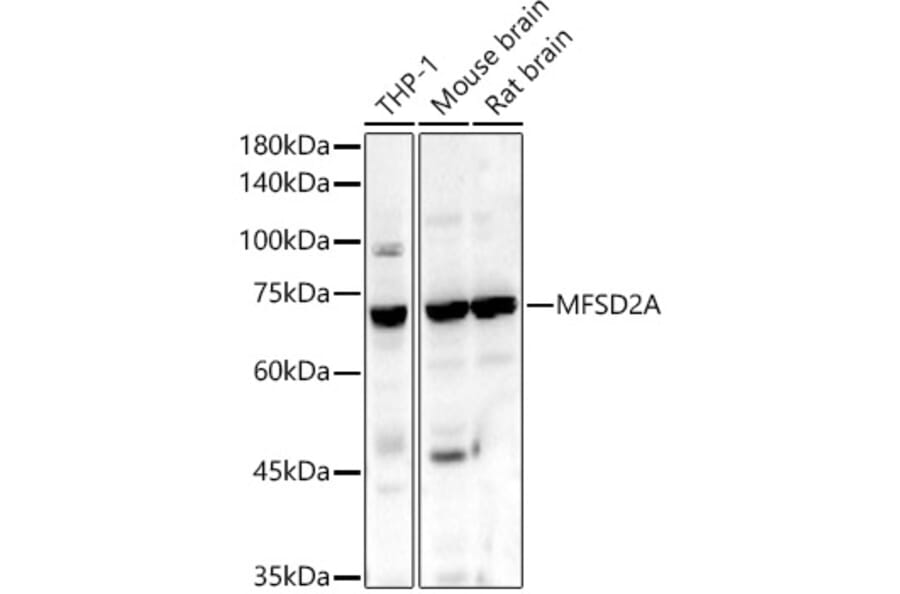 Western Blot - Anti-MFSD2A/NLS1 Antibody (A305560) - Antibodies.com