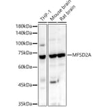 Western Blot - Anti-MFSD2A/NLS1 Antibody (A305560) - Antibodies.com