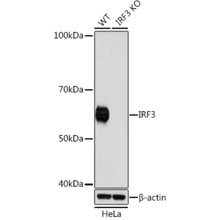 Western Blot - Anti-IRF3 Antibody [ARC0198] (A305561) - Antibodies.com